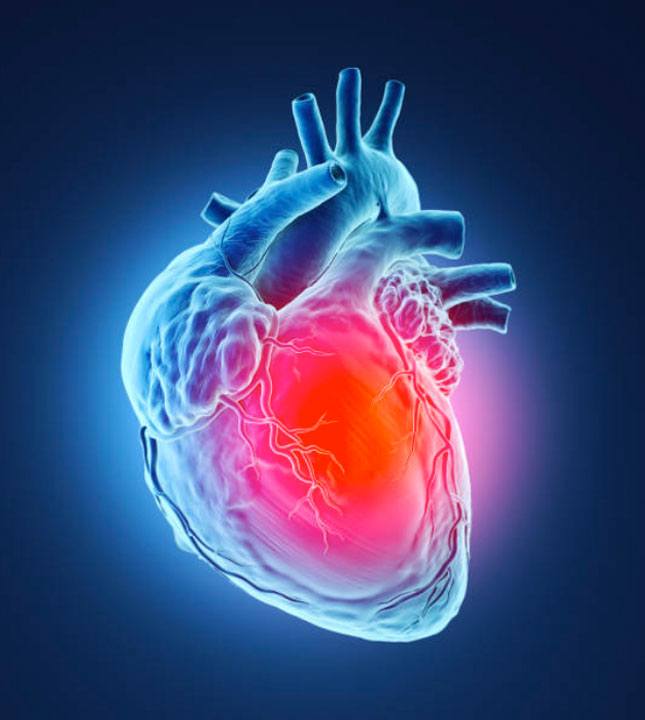 Red and blue heart CT Scan Illustration