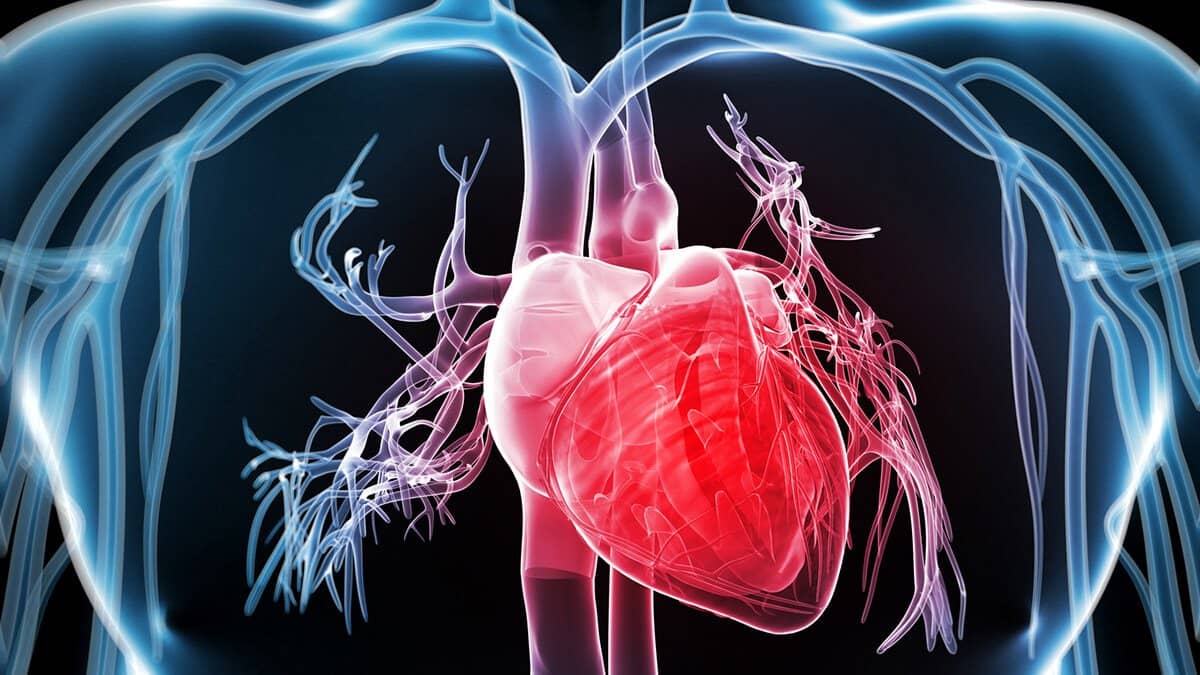 Heart CT Scan illustration