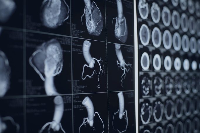 CT Heart Scan images