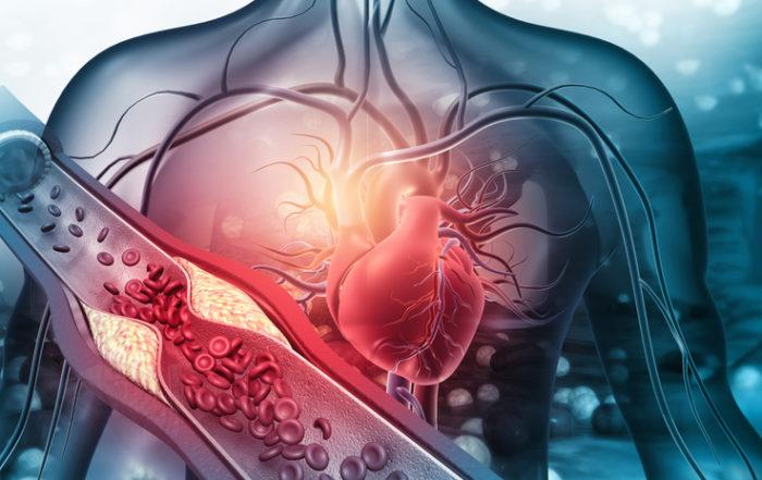 Human heart with blocked arteries illustration