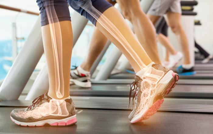 Woman walking on treadmill with diagram of leg bones