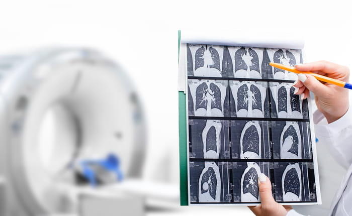 A doctor reviewing chest CT results in front of a CT scanner.