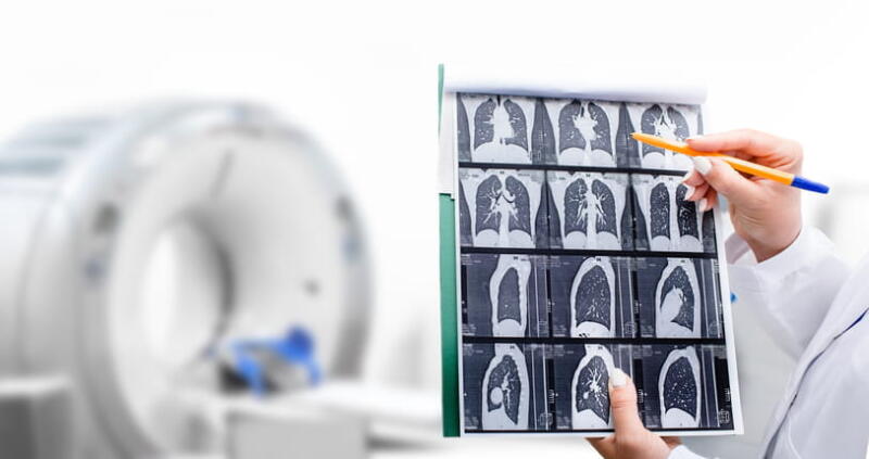 A doctor reviewing chest CT results in front of a CT scanner. 