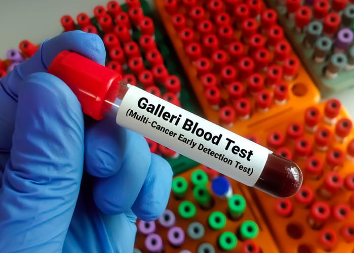 A vial filled with blood labeled: "Galleri Blood Test (Multi-Cancer Early Detection Test).