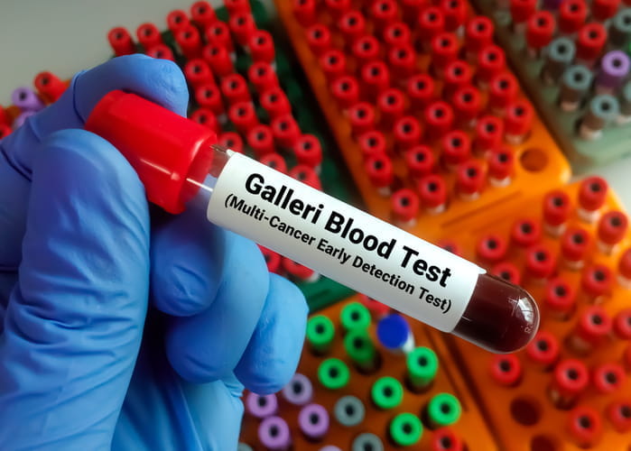 Importance Of A Multi Cancer Early Detection Test