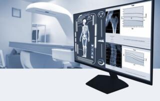 illustration of bone density scan on a computer monitor