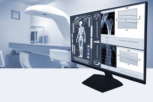 illustration of bone density scan on a computer monitor