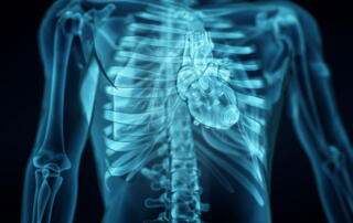 A 3D Medical Illustration Showing A Blue, X-Ray Style View Of The Human Torso. The Image Details The Rib Cage, Spine, And The Heart Positioned Within The Chest Cavity.