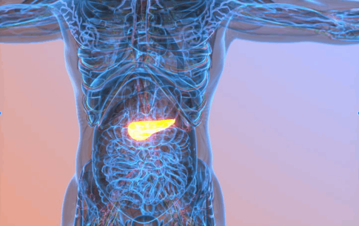 How Do You Detect Pancreatic Cancer Early?
