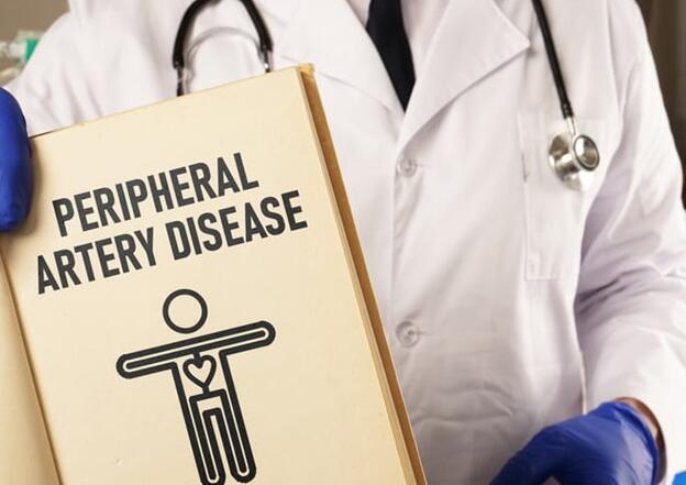Blog 3 A Doctor Holds A File Labeled &Quot;Peripheral Artery Disease.&Quot;